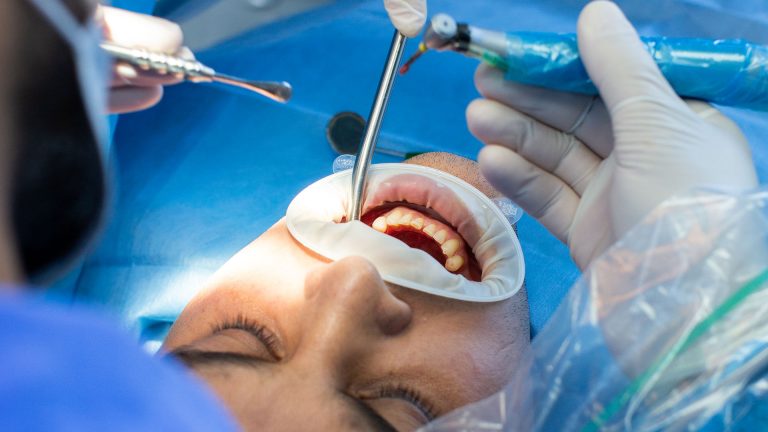 Ağız Diş ve Çene Cerrahisi - Dent Ekspres Eskişehir